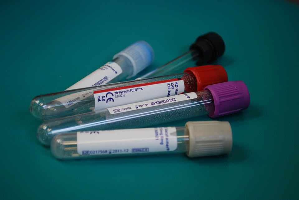 lab test