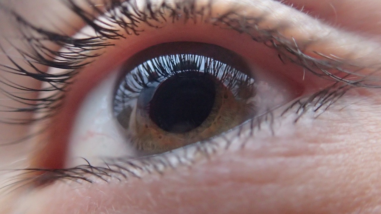 eyelid surgery